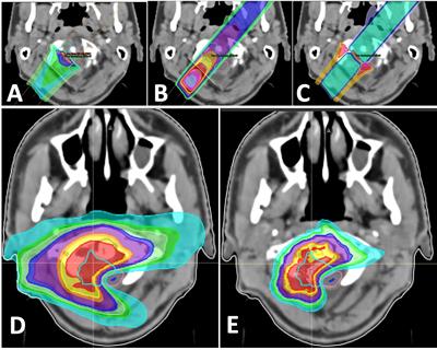 Biological and Mechanical Synergies to Deal With Proton Therapy Pitfalls: Minibeams, FLASH, Arcs, and Gantryless Rooms